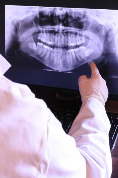 Best 24-Hour Emergency Dentist in Glenmont, MD