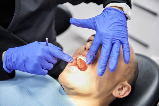Best Same-Day Emergency Dentist in Glenmont, MD